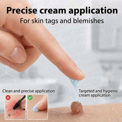 HISKIN® 10-in-1 Targeted Skin Tag & Dark Spot Cream – 7-Day Painless, Scar-Free Herbal Formula
