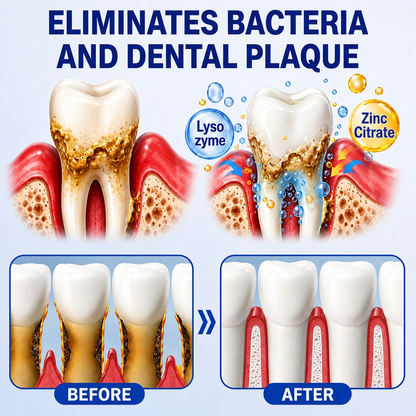 👨‍⚕️✅🦷 HISKIN® GumRevive Periodontal Repair Gel