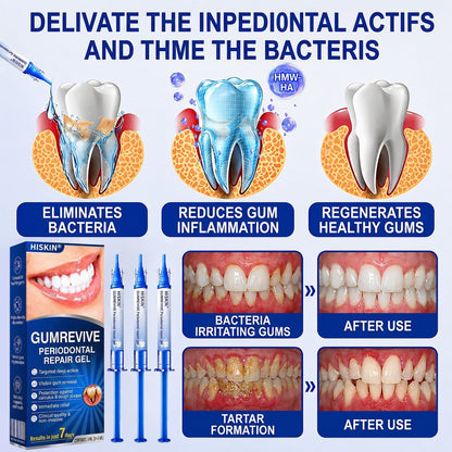 👨‍⚕️✅🦷 HISKIN® GumRevive Periodontal Repair Gel
