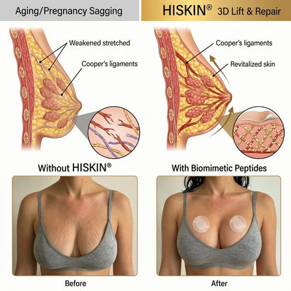 HISKIN® Advanced Volumizing & Firming Micro-Infusion Patch: Targeted Nano-Tech for a Fuller, Lifted Bust